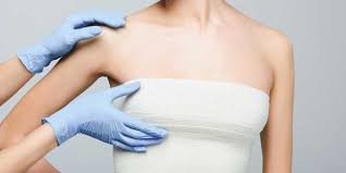 What to Expect During Your Recovery After Breast Reduction in Dubai