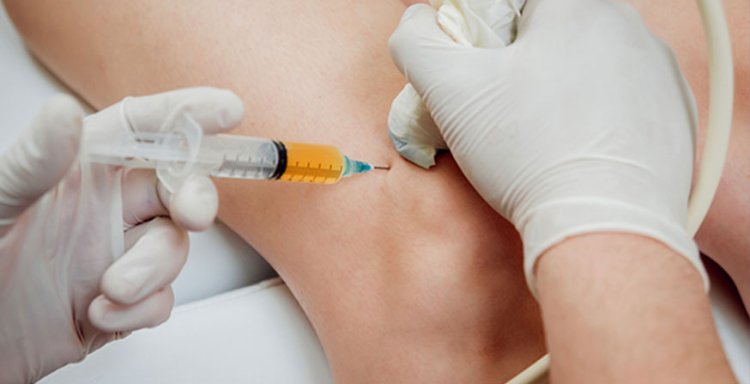 PRP Full Form: Understanding Platelet-Rich Plasma Therapy