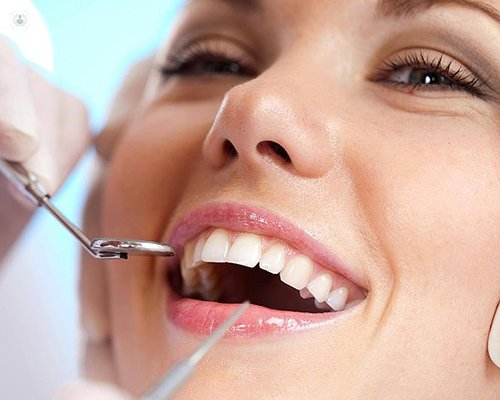 Rediscover a Confident Smile with Dental Implants in Tampa at Your Desired Smile