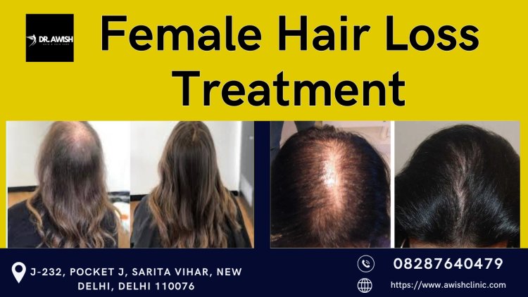 Female Hair Loss Treatment Understanding Causes & Effective Solutions